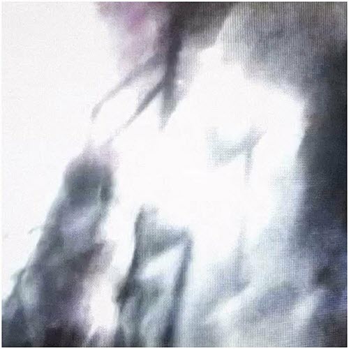 Kraus - Anything Else (2023) [Single]