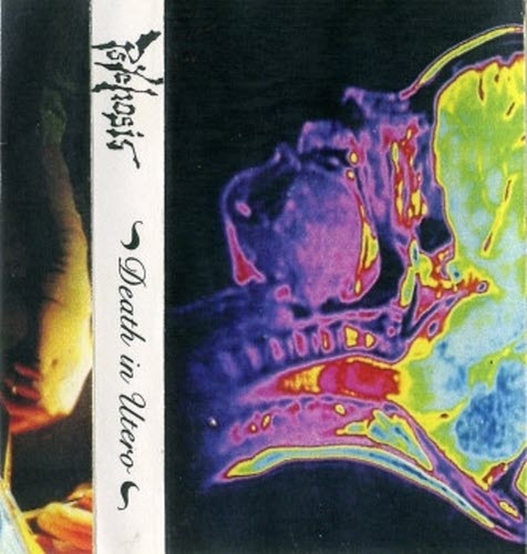 Oneiroid Psychosis - Death In Utero (1992)