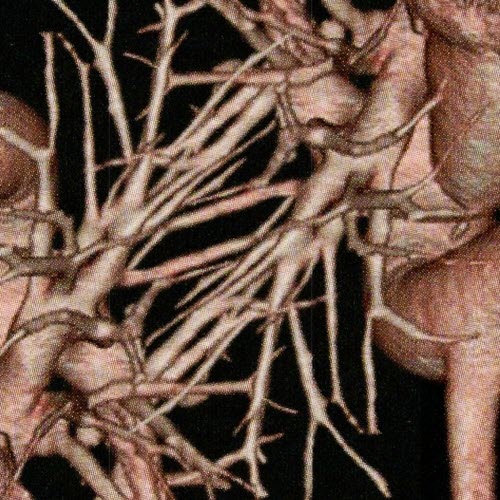 Insula Iscariot - Weak Incision (2024) [Single]