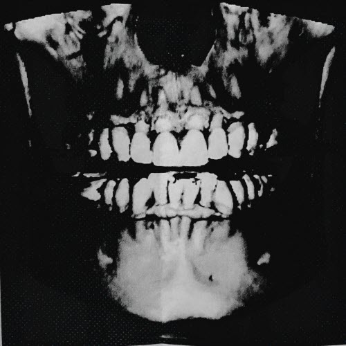 Hypersomnia - Fractured (2026) [Single]